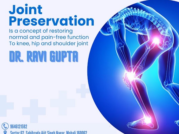 Joint Preservation